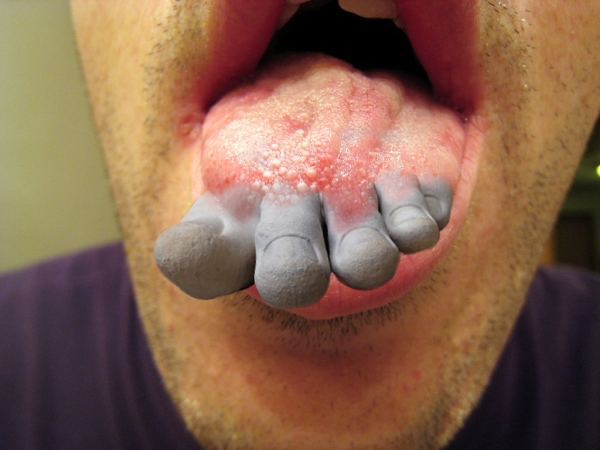 Creation of Do I Have Athlete's Tongue?: Step 1